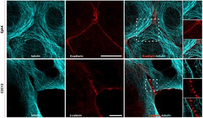 Junctional ER Organization Affects Mechanotransduction at Cadherin-Mediated Adhesions